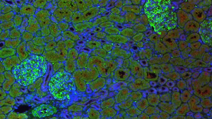 Microscopic image of human biopsy.