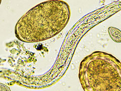 Image: Parasitic infection