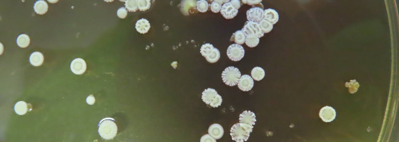 A close up of a petri dish showing a brown jelly like substance and white dots growing on top.
