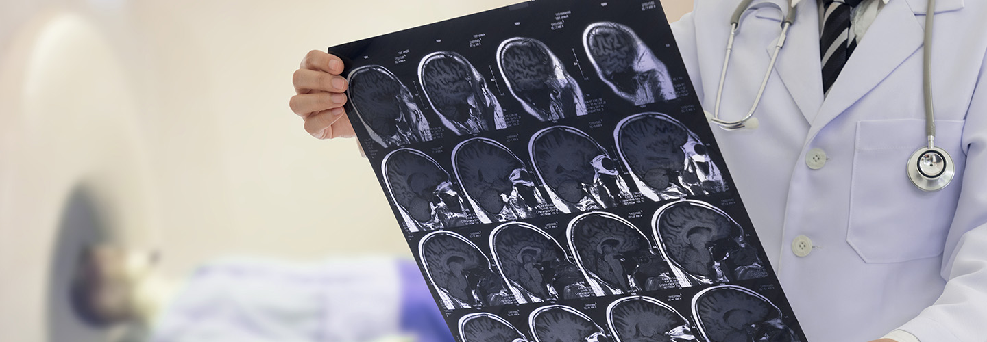 A doctor reviewing brain scans.