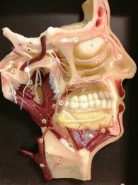 Model of the head and neck showing arteries, nerves and muscles.